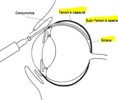 공막, 구조와 기능. 눈의 뼈대!