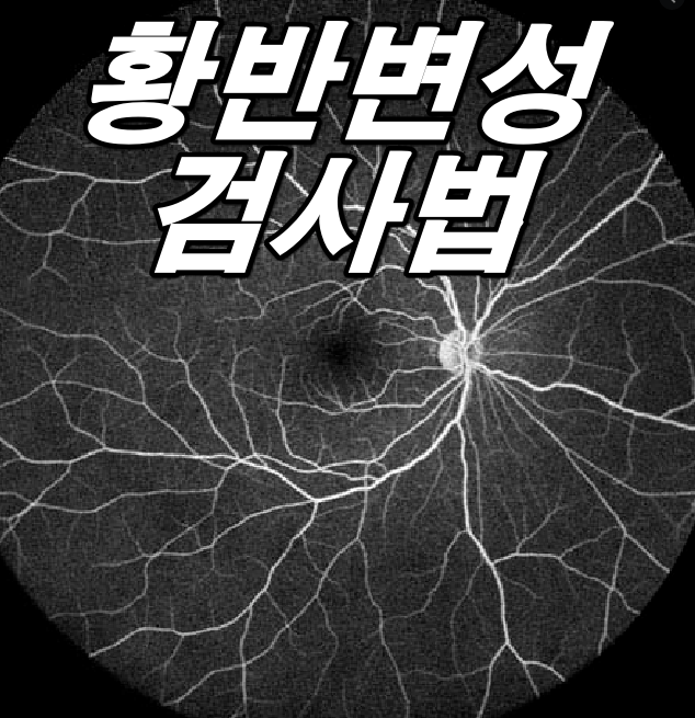 황반변성 검사 - 안과 검사방법에 대하여(황반변성 Part.3)