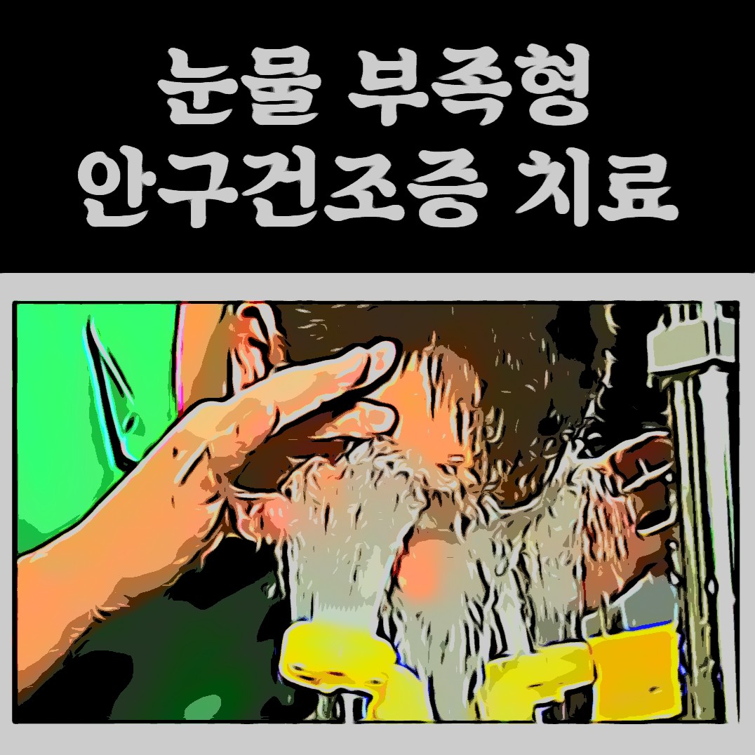 눈물부족 안구건조증의 치료(feat. 누점폐쇄술)(안건 시리즈 Part.05-3)