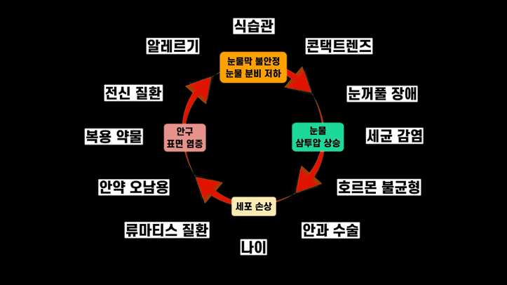 안구건조증 병태생리