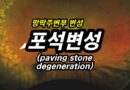포석변성(paving-stone degeneration) – 망막 주변부 변성 10