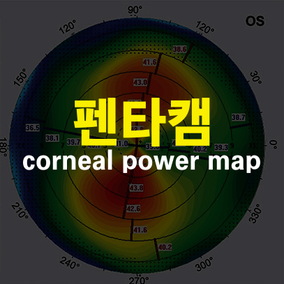 펜타캠 해석 – Corneal Power Map