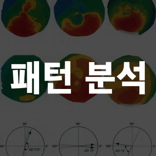 펜타캠 해석 – corneal power map 3