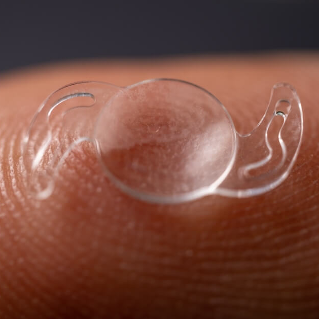 백내장 수술 순서에 대한 고찰