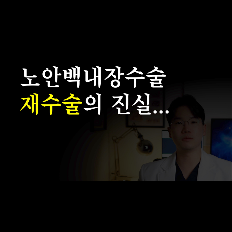 백내장 재수술, 정말 하면 다 좋아질까?