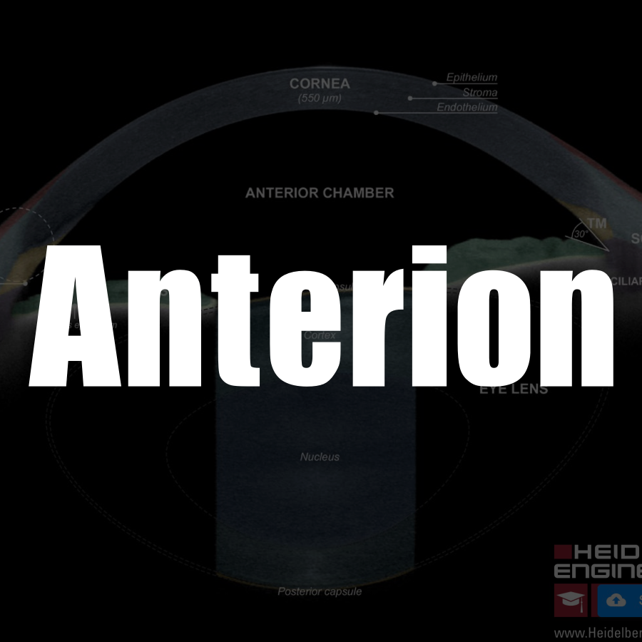 Anterion과 친해지기 