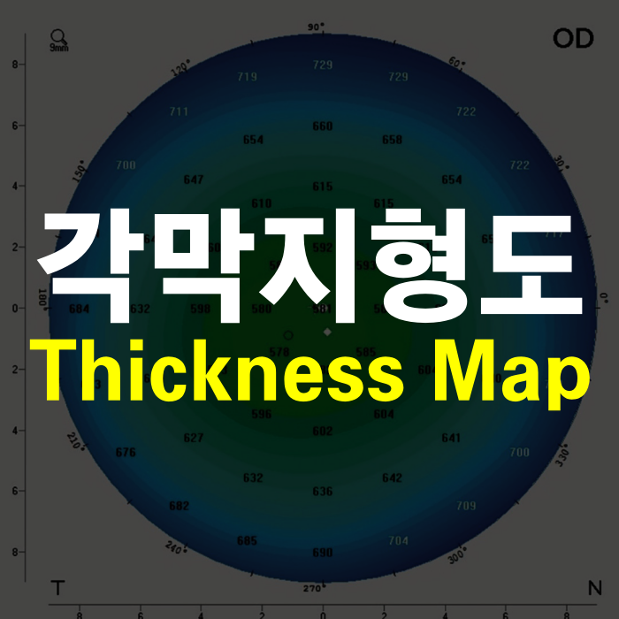 각막지형도 – thickness map 1