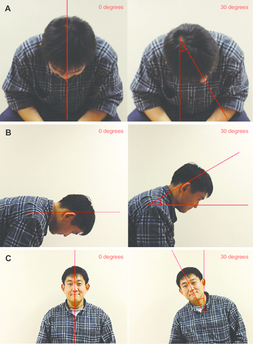 Positioning-on-human-model-Notes-A-axial-rotation-B-anterior-elevation-looking.png